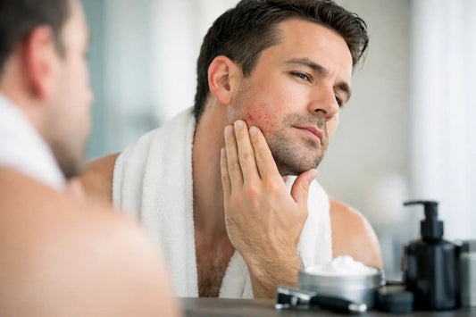How to Prevent Post Shave Irritation for Good